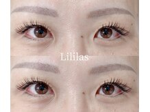 リリラース(Lililas)/