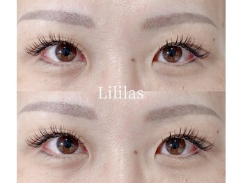 リリラース(Lililas)/
