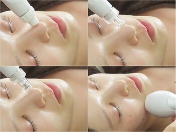 ヴィーダ 渋谷松濤(ViDA)の写真/頑固な毛穴の開き・毛穴の黒ずみさよなら!ハイドラシャイン×プラズマ殺菌でつるんとなめらか美肌