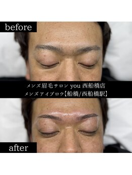 ユー 西船橋店(you)/ビフォーアフター写真