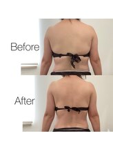 レスプロンディール(Resplendir)/骨盤矯正＆痩身機器