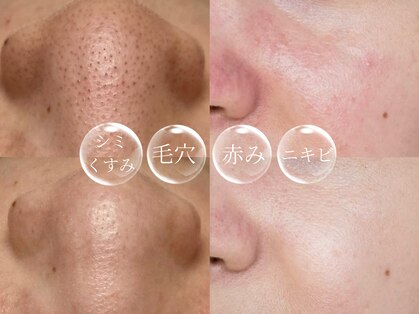 ルナベル(Luna Bell)の写真