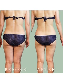 小さなおうちサロン こぐまの寝床/ビフォーアフター