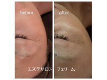 フェリームー(feerie mu)の雰囲気（【シワ改善】ララピール/毛穴/疲れ顔/たるみ/ハリツヤ）