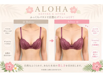 アロハ 千葉 稲毛(ALOHA)の写真