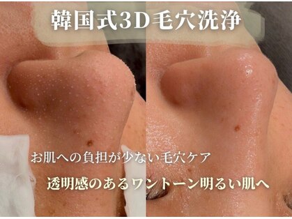 グレース(grace)の写真