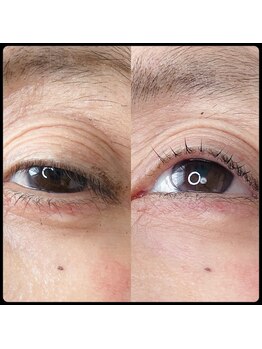 カルペディエム(Carpe diem)/