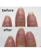 ジュノ ネイルアンドスクール(Juno)/ケア