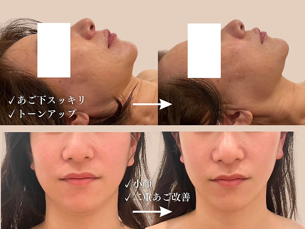 神戸市でEMSが人気のエステサロン｜ホットペッパービューティー