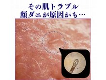 高額契約、ローン契約がないから安心でカジュアル