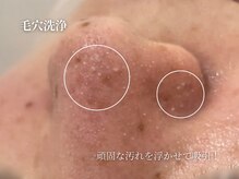 コウル 川西能勢口店(geoul)/毛穴洗浄 3D毛穴美人コース