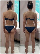 エーエフビューティーエステ(AF Beauty Esthetic)/骨盤トリムケア