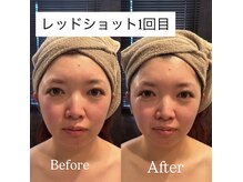 白美の雰囲気（痩身／脂肪／小顔／シミシワ改善／レッドショット／ブライダル◎）