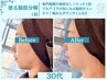 限定1名【新人応援】医療提携!塗る脂肪分解で初回から変化実感◎二重アゴ解消