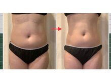 アリス 赤坂の雰囲気（代謝が落ち今までのダイエット法では痩せない大人女性に）