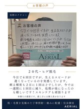エアリアル 中津店/ヒゲ脱毛お客様の声