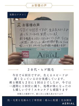 エアリアル 中津店/ヒゲ脱毛お客様の声