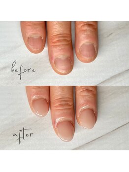 ユユネイル(yuyu nail)/【深爪】一瞬で美爪+ワンカラー