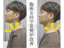 リバティ 世田谷代田整体院(Liberty)/短期集中改善後、「姿勢が改善」