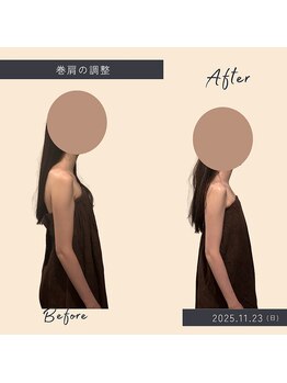 ソロウノ 平和島本院/巻肩改善