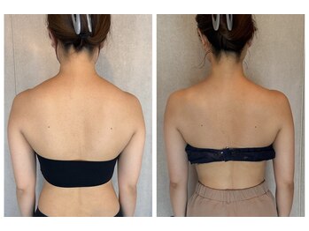 コルノ ラッシュアンドビヨンド(Corno Lash&beyond)の写真/リピート率9割越えの理由がここに!【頑固な脂肪を徹底燃焼】特殊マシン×最高濃度液剤で速攻激痩せ体験