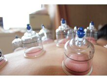 アンジェリカビューティー(Angelica Beauty)/カッピング