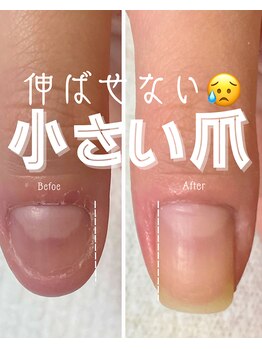 お客様のビフォーアフター写真