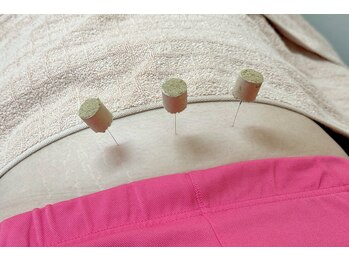 命水鍼灸院/生理不調【新宿/鍼灸】