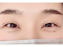 ミリミリ(milimili)/◇施術イメージ◇