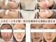 ニキビ研究所 千葉店の写真