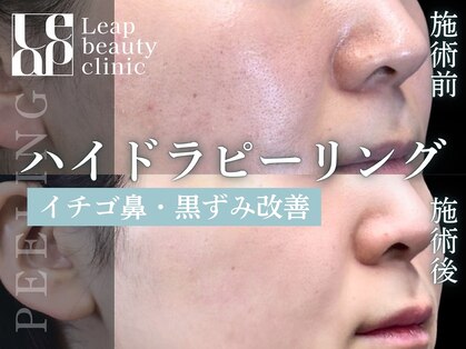 リープ(Leap)の写真