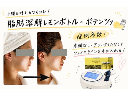 ビヌ(Binu)の写真