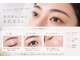 ビジュネ(Bijounet)の写真