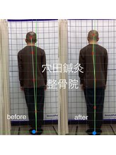 穴田鍼灸整骨院/整体・骨盤・ねこぜ・まき肩矯正