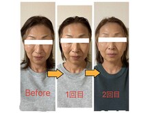 エムズ ラボ(M's Labo)の雰囲気（リスクなしでシワ緩和、ハリ肌に変化♪周りからも褒められ肌に！）