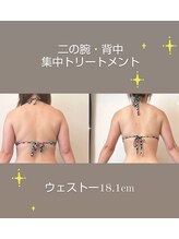 レナトゥス 銀座(Renatus)/大幅減量マイナス15kg☆r