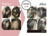 【直前予約】ドライヘッドスパ頭皮育毛促進・幹細胞培養液導入初回体験￥9900