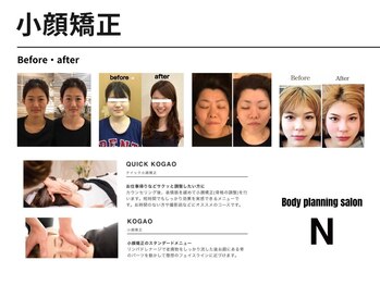 エヌ(N)/サロンNの小顔矯正は恵比寿１！
