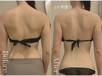 ユーフォリア グロウ(euphoria glow)