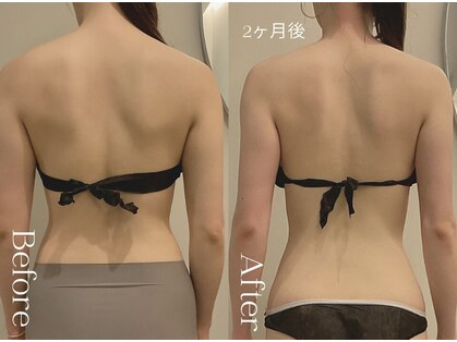 ユーフォリア グロウ(euphoria glow)の写真