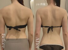 ユーフォリア グロウ(euphoria glow)