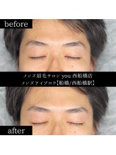 ユー 西船橋店(you)/ビフォーアフター写真