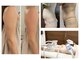 ソフィームの写真/二の腕/ハミ肉に集中ケア◎大人気★脂肪冷却×EMSで脂肪細胞に徹底アプローチ♪[立川/痩身/ダイエット]