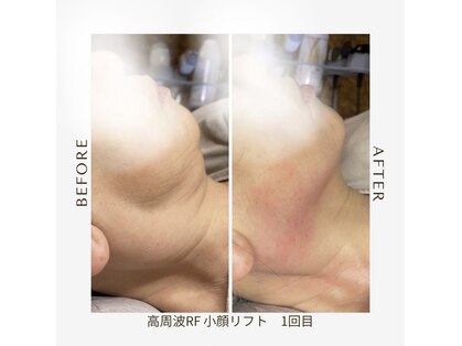 ワイビューティ(Y.Beauty)の写真
