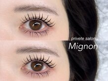 ミニョン(Mignon)