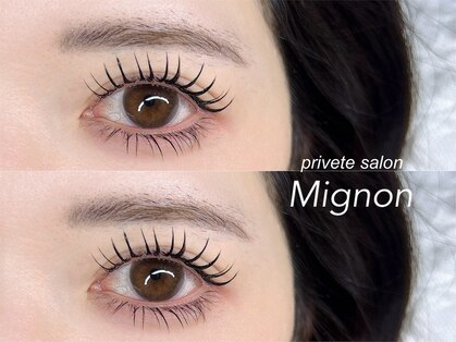 ミニョン(Mignon)の写真