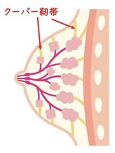 【原因４★　クーパー靭帯が伸びている】