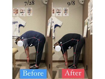 ナオル整体 宮崎院(NAORU整体)/30代男性施術事例【柔軟性UP】