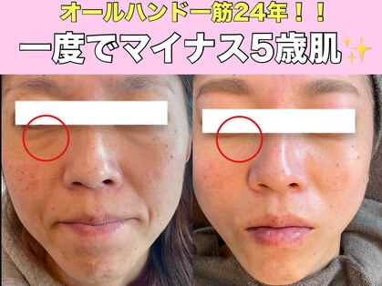 チル スキンスタジオ(CHILL skin studio)の写真
