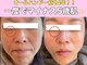 チル スキンスタジオ(CHILL skin studio)の写真